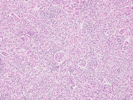 奧林巴斯顯微鏡