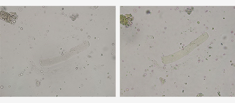 奧林巴斯顯微鏡